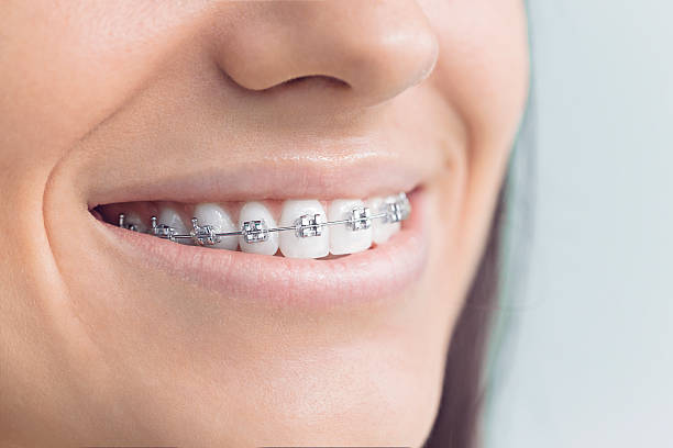 Best Dental Fillings (Composite and Amalgam)  in Patchogue, NY